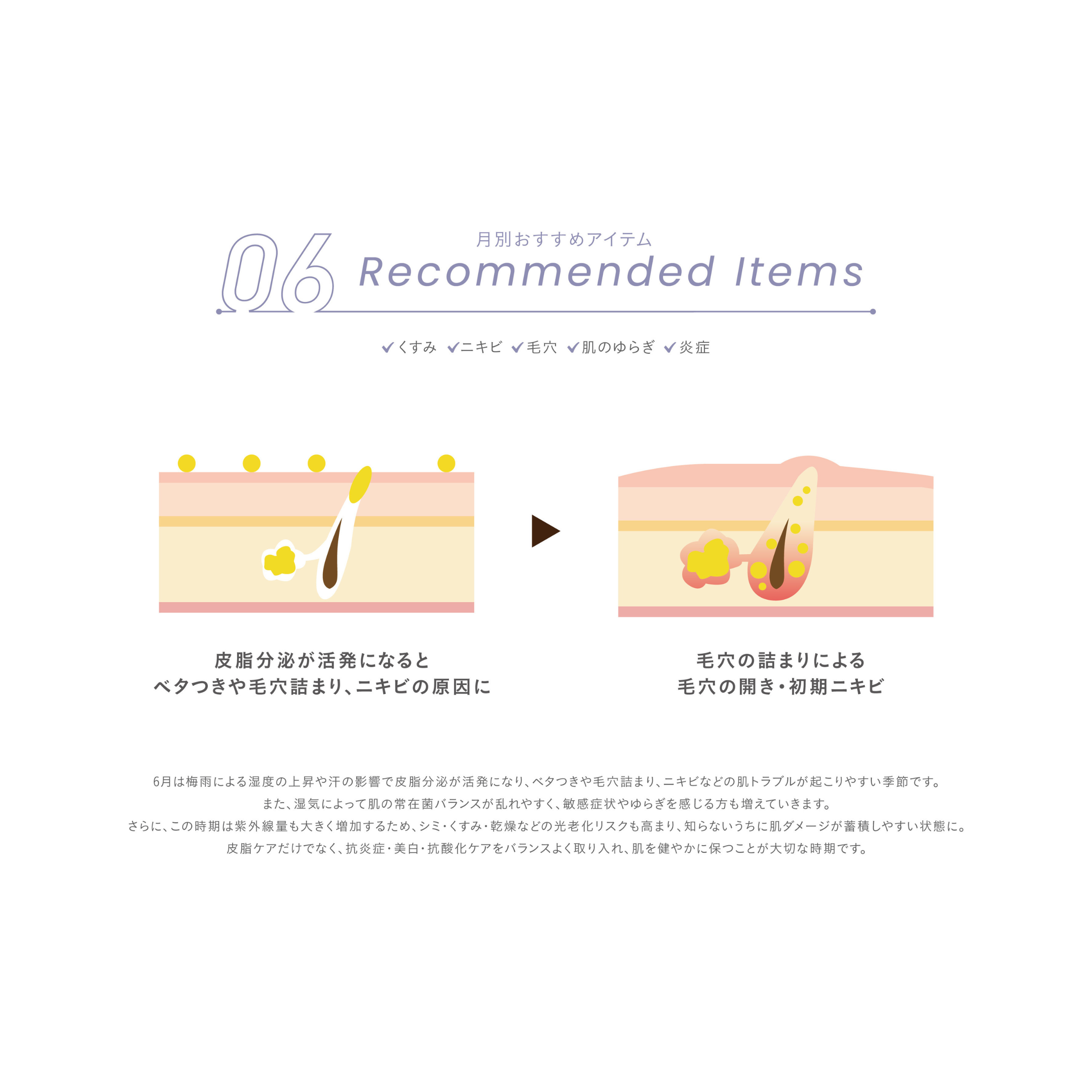 SEASONAL ITEM‐6月肌状態‐